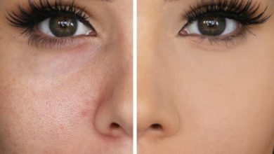 Photo of Si t’i mbyllni poret e fytyrës pa shkuar fare te dermatologu