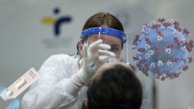 Photo of 32 humbje jete nga virusi në Greqi, 2636 raste të reja dhe 329 të intubuar