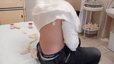 Photo of Prindi nga Shkupi thotë se djali i përfundoi ne spital nga sfidat e TikTok, ben thirrje për kujdes ndaj fëmijëve