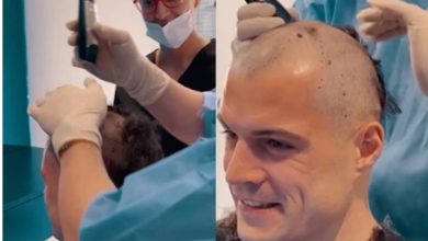 Photo of “Blick” shkruan për transplantin e flokëve që Xhaka e bëri në Kosovë