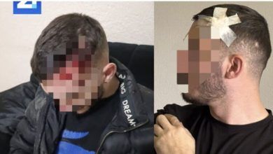 Photo of I riu nga Shkupi thotë se është rrahur brutalisht nga Policia