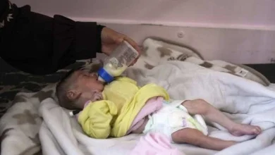 Photo of “Washington Post”: Në Gaza foshnjet po vdesin, spitalet janë të tejmbushura me fëmijë të uritur dhe mjekët mezi qëndrojnë në këmbë