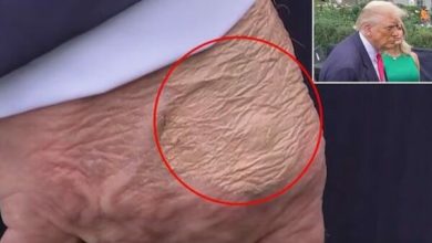 Photo of Disa shenja shfaqen në dorën e Trumpit, ekspertët zbulojnë se çfarë janë ato në të vërtetë