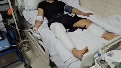 Photo of 16 efektivë të plagosur, Ministrja e Brendshme shkon në spital: Kanë djegie të konsiderueshme, nuk ishte protestë, por tentativë vrasjeje
