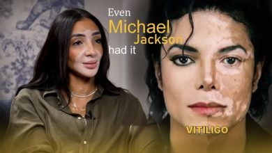 Photo of Publiku e keqkuptoi për vite”/ Modelja: Michael Jackson nuk e ndryshoi vetë lëkurën, tregon detaje për sëmundjen e tyre