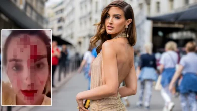 Photo of Skandal në Kanë/ Miss Venezuela publikon videon tronditëse me fytyrën e mbuluar në gjak, akuzon stilistin e njohur për dhunë