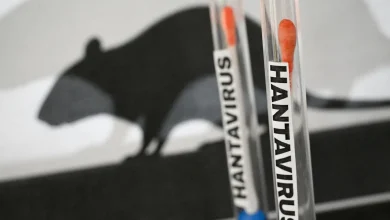 Photo of Rreziku i ‘murtajës’ moderne – Çfarë është hantavirusi?