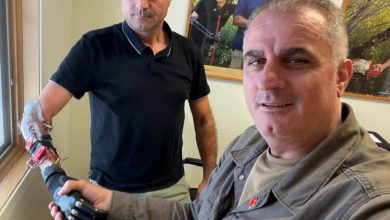 Photo of Emocionuese: Pas 28-vjetësh invalidi i luftës që e humbi dorën kur ishte 20-vjeçar, vendos dorë teknike