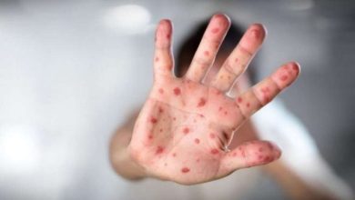 Photo of 11 raste për një javë, shkon në 69 numri i të prekurve nga fruthi në Kosovë