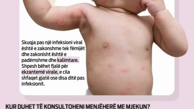 Photo of LAOR Medical: Skuqja në lëkurë pas një infeksioni viral tek fëmijët – jo çdo skuqje është arsye për panik!