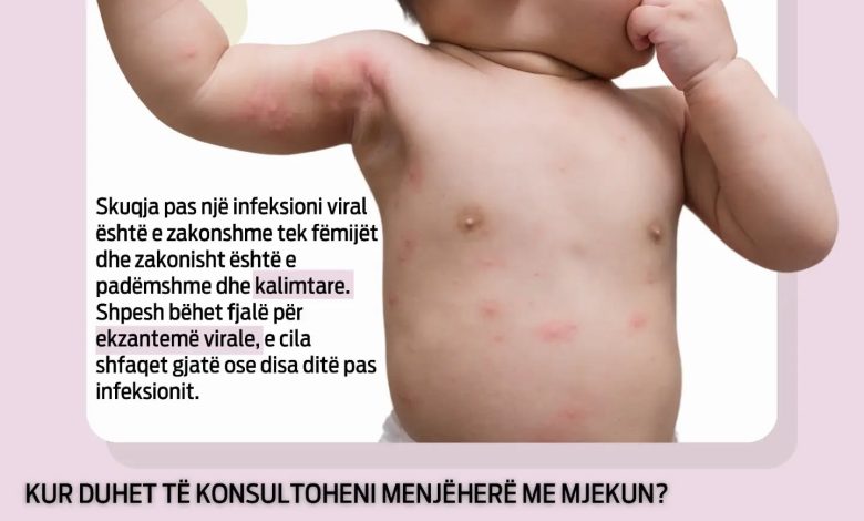 LAOR Medical  Skuqja në lëkurë pas një infeksioni viral tek fëmijët   jo çdo skuqje është arsye për panik 