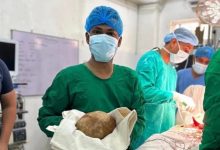 Photo of Mjekët heqin një gur prej 3,1 kilogramësh nga fshikëza e një burri