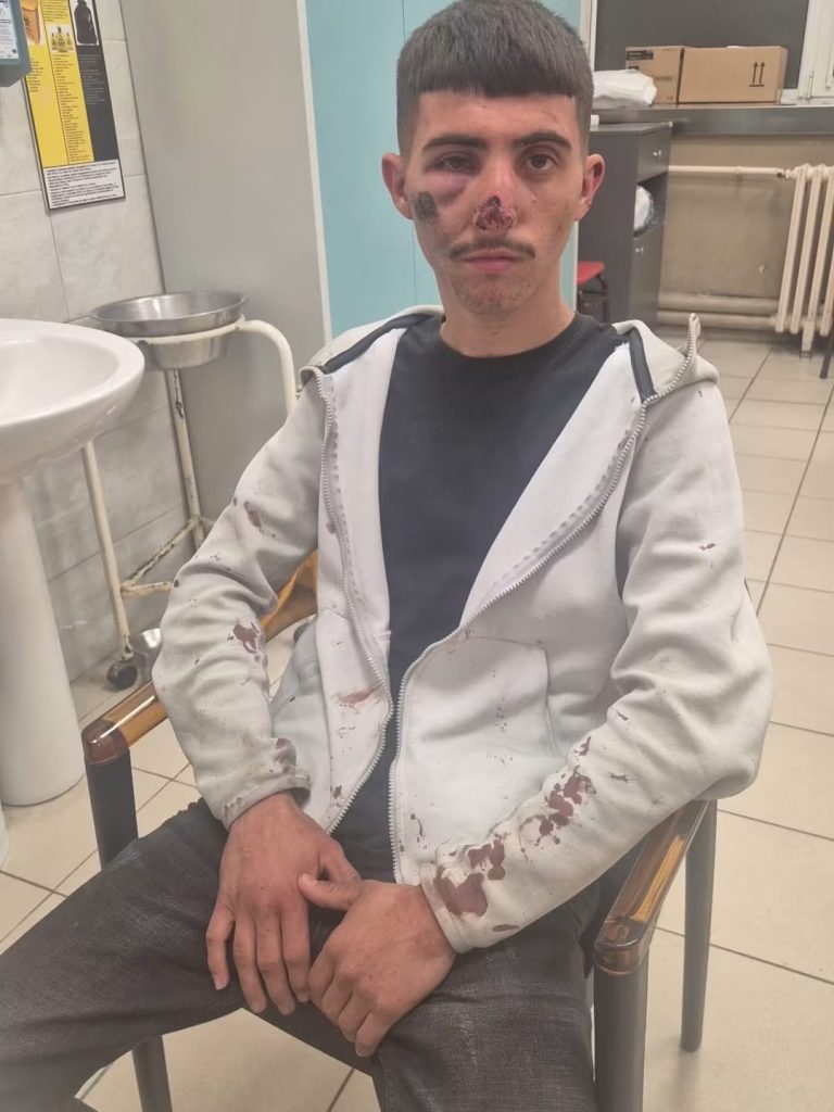 Informacione të reja për rastin e dy të rinjve që pretendohet se u rrahën në Shkup   Të gjithë policët do të sanksionohen   patrulla dyshohet se quhej  Jugosllavia  dhe kishte përbërje të përzier etnike