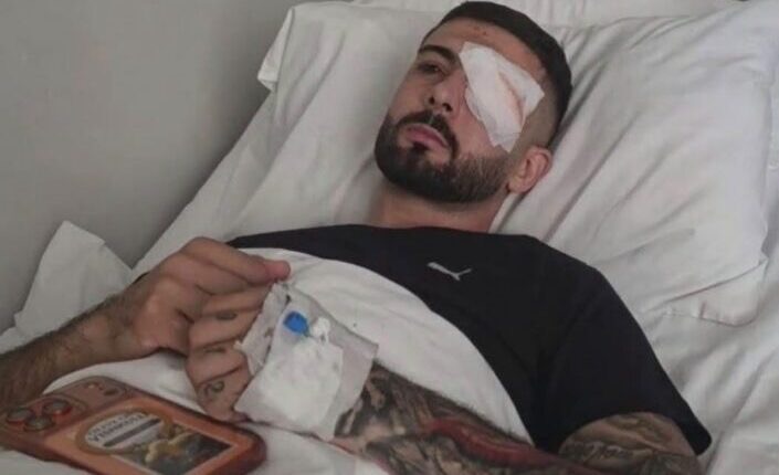 Momenti kur Erjon Vishkulli qëllohet me plumb gome në sy  ulërimat dhe rrëzimi i 28 vjeçarit  VIDEO 