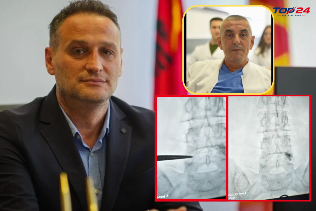 Erzen Elezi jep lajmin e madh  Për herë të parë në Spitalin Klinik të Tetovës realizohet infiltracionet periradikulare dhe iliosakrale me PRP